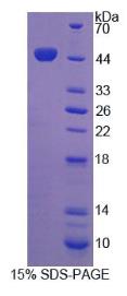 SDS-PAGE (ITGB1-5770H).jpg